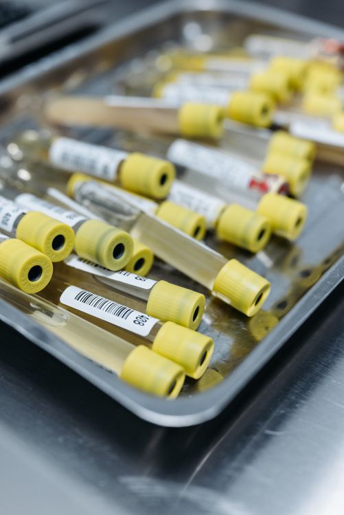Laboratory sample tubes on a metal tray
